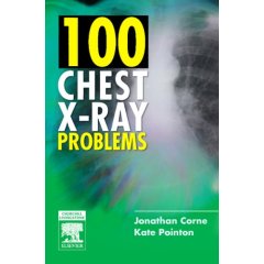 100 Chest X-Ray Problems