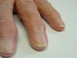 Medical Finals Quiz Hands