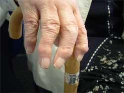 Medical Finals Quiz Hands