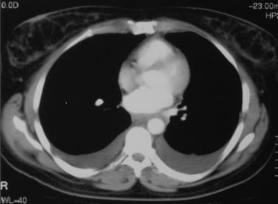Medical Finals Quiz CT 1