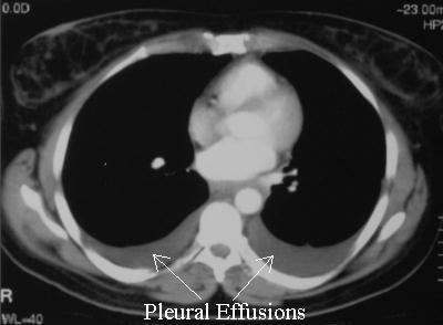 Medical Finals Quiz CT 1 annotated