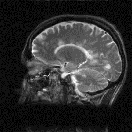 MRI-Brain 4