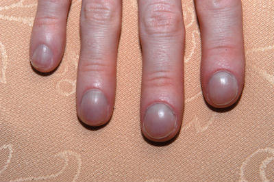 Fingers