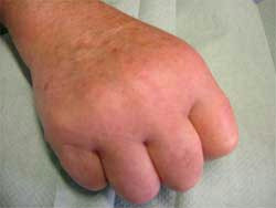 February Quiz Hand Picture