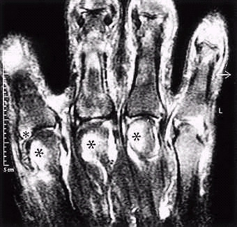 February Quiz Hand XRay