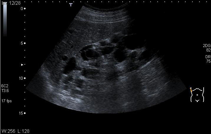 February Quiz Ultrasound Abdomen