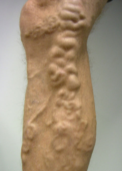 Leg