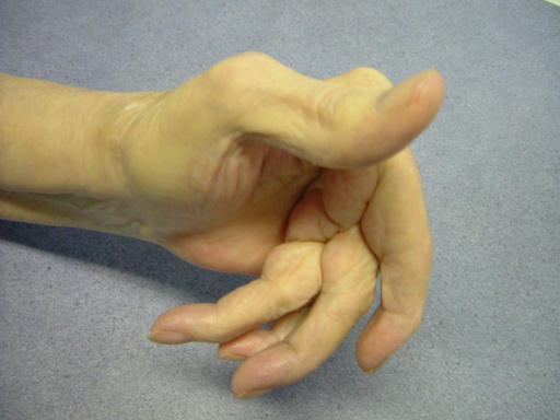 Hand