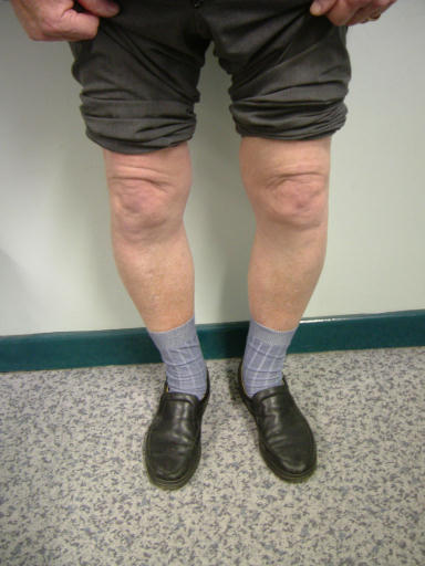 Knees