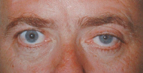 Face