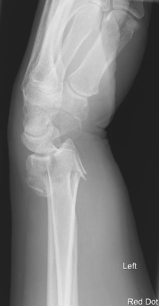 X-ray 1
