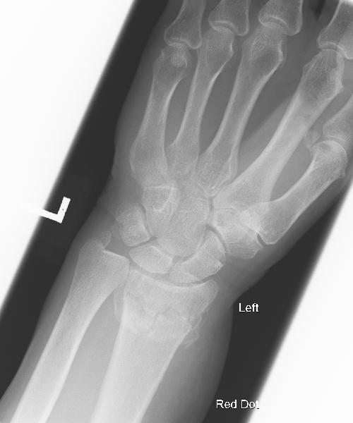 X-ray 2