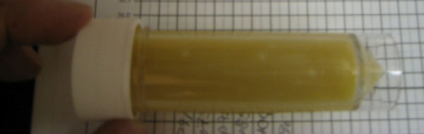 March Quiz Joint Aspirate